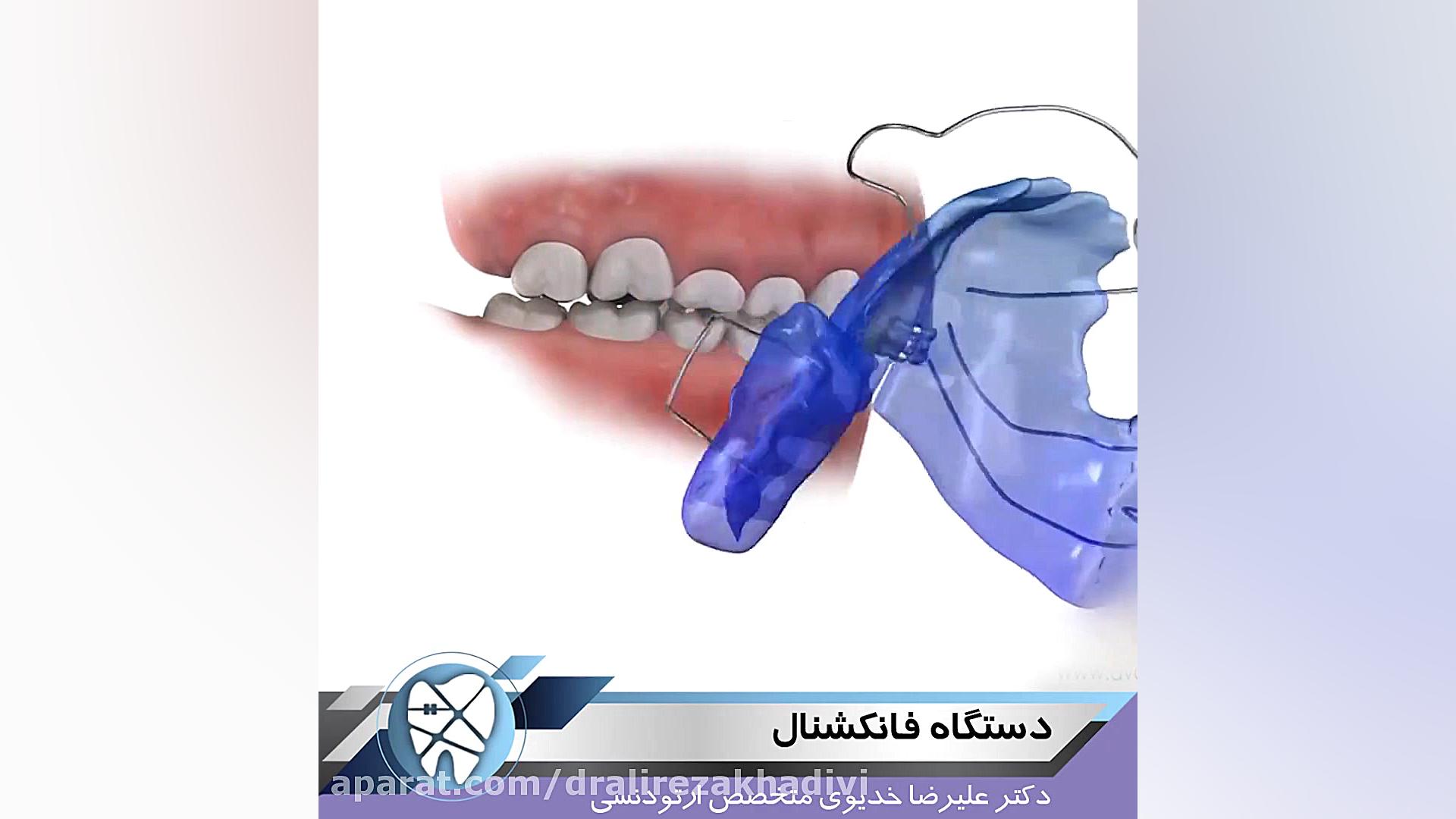 دستگاه فانکشنال دکتر علیرضا خدیوی