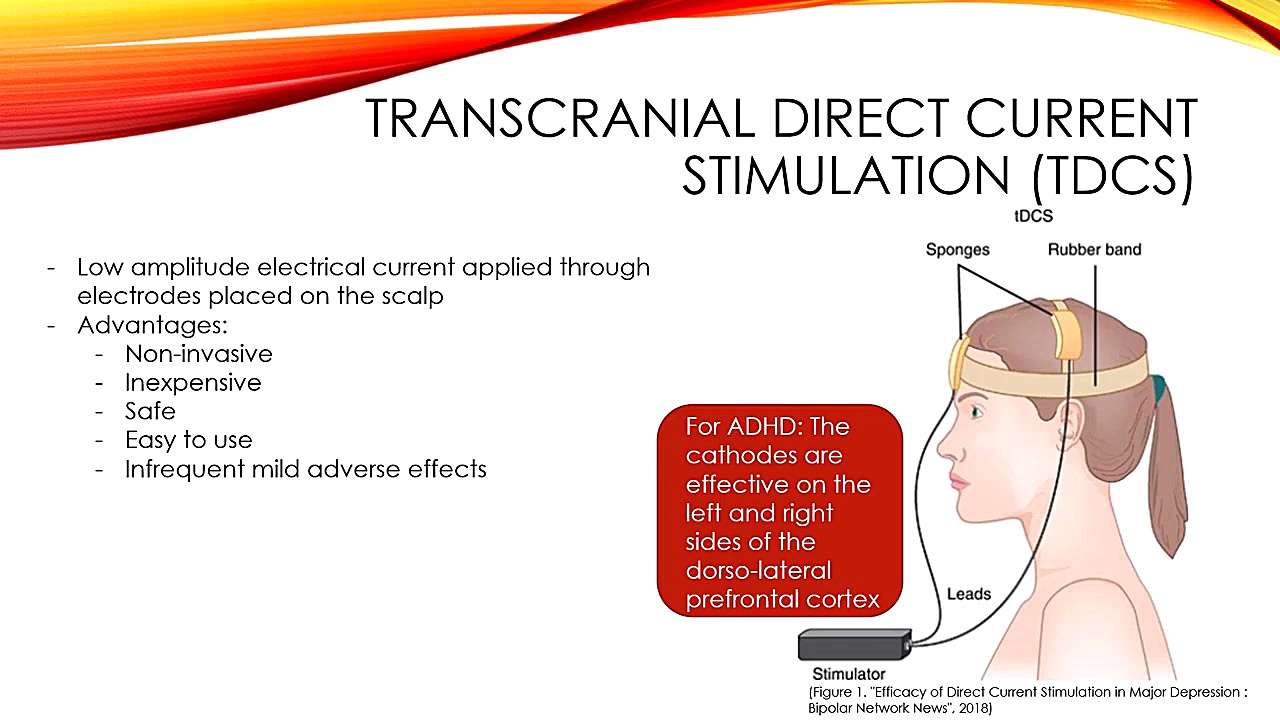 The Effect of tDCS on ADHD اما استون