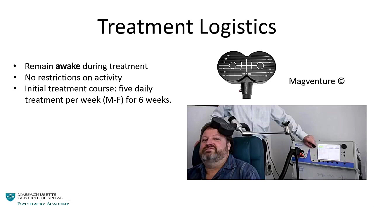 TDCS: A New Treatment Approach for Psychiatric Disorders کلینیک مو