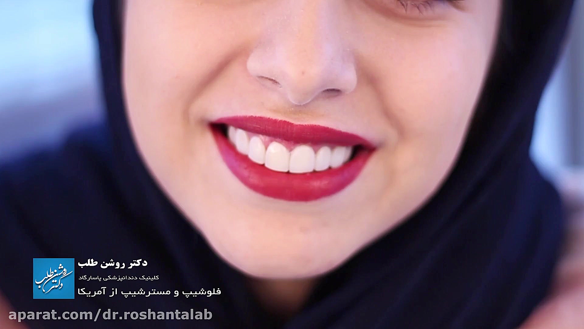 لیفت لثه و کامپوزیت ونیر کلینیک دندانپزشکی پاسارگاد بیوسنسور لاکتات خون