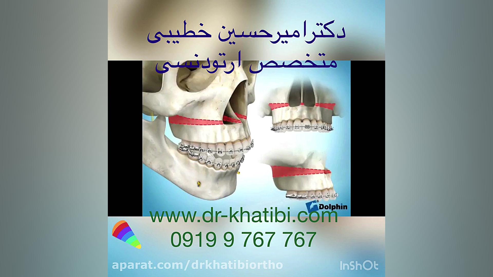 جراحى اپن بایت دکتر امیرحسین خطیبی