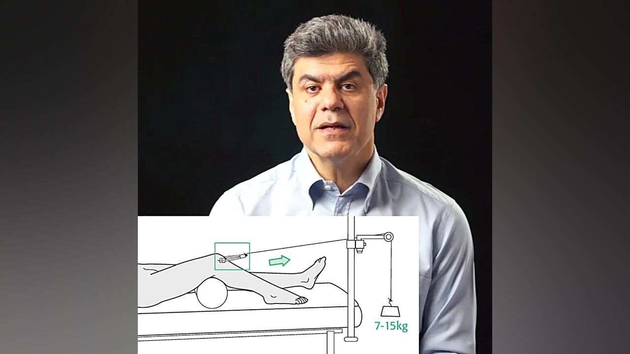 شکستگی استابولوم را باید جراحی کرد یا خیر محسن چاوشی
