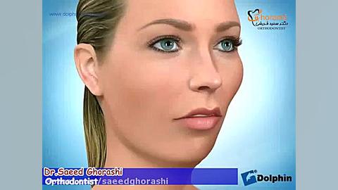 تنگی نفس در زمان خواب - دکتر سعید قریشی جرمگیری