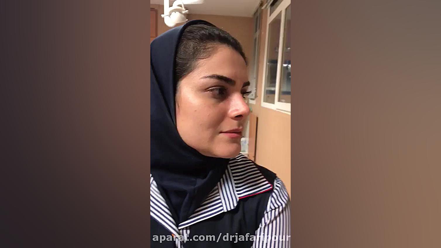 رضایت بیمار پس از جراحی زیبایی بینی دکتر مسعود جعفری پور