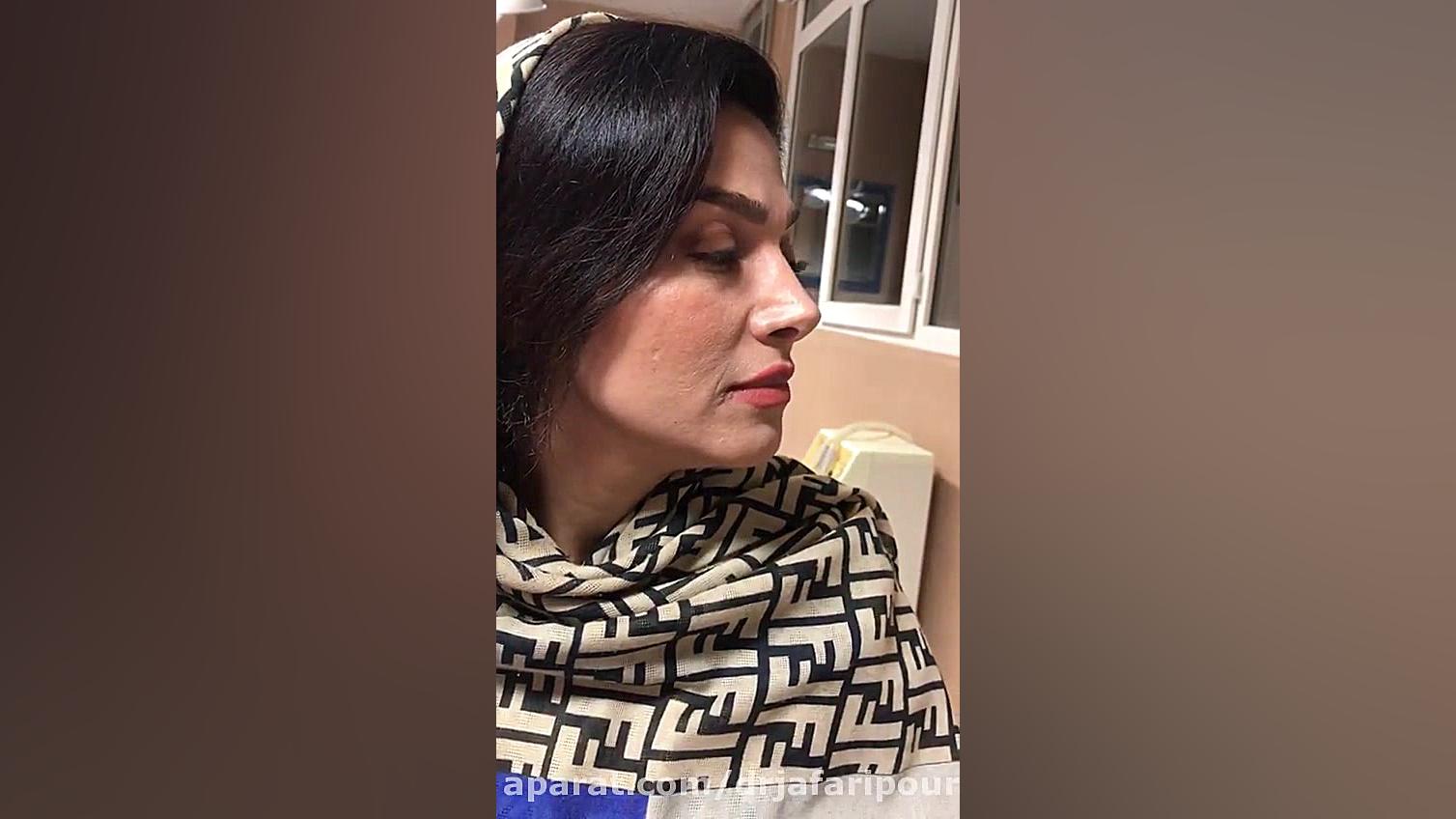 نتیجه رضایت بخش بیمار از جراحی زیبایی بینی دکتر مسعود جعفری پور