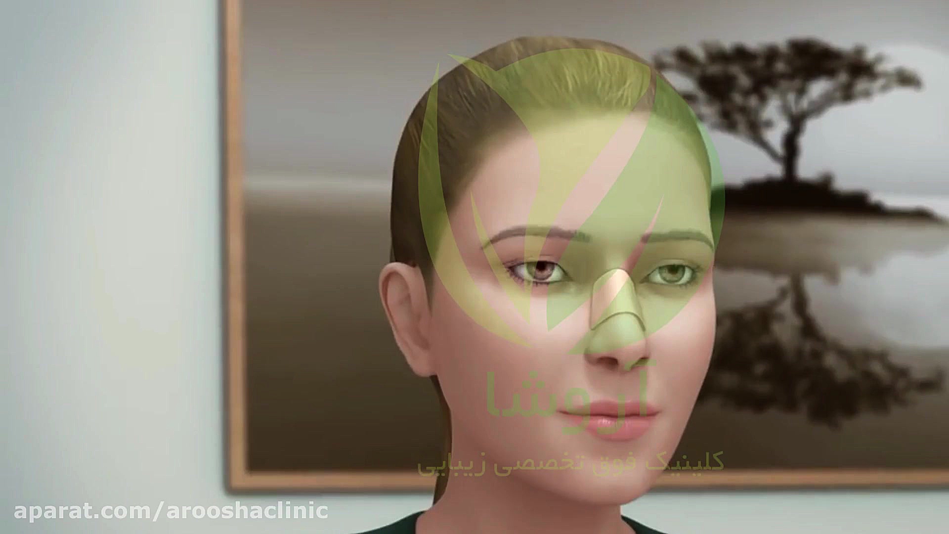 جراحی زیبایی بینی کلینیک زیبائی دکتر مهرشاد رابط