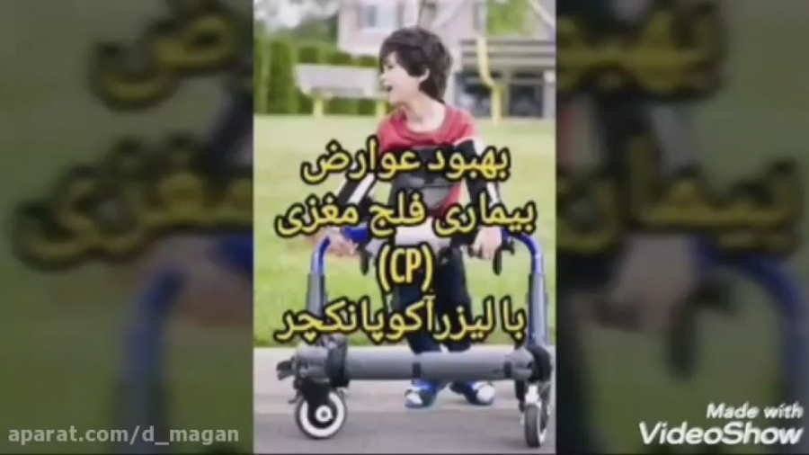 بهبود عوارض بیماری فلج مغزی (CP) با لیزرآکوپانکچر (قسمت ۱) کیم کارداشیان