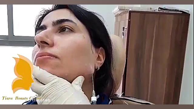 زاویه سازی فک و صورت RNA Interference Assay