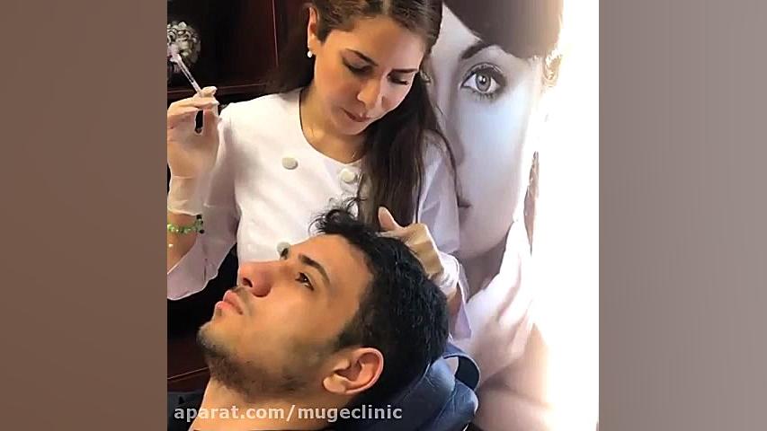 مزوتراپی درمان ریزش مو والسارتان