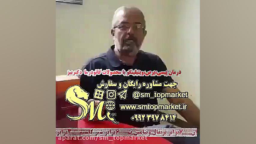 درمان پیسی یا ویتیلیگو برص تنبان گشاد