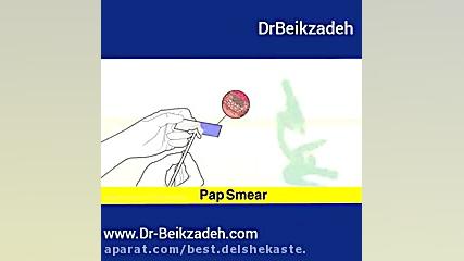 تست پاپ اسمیر دندانپزشک زیبایی