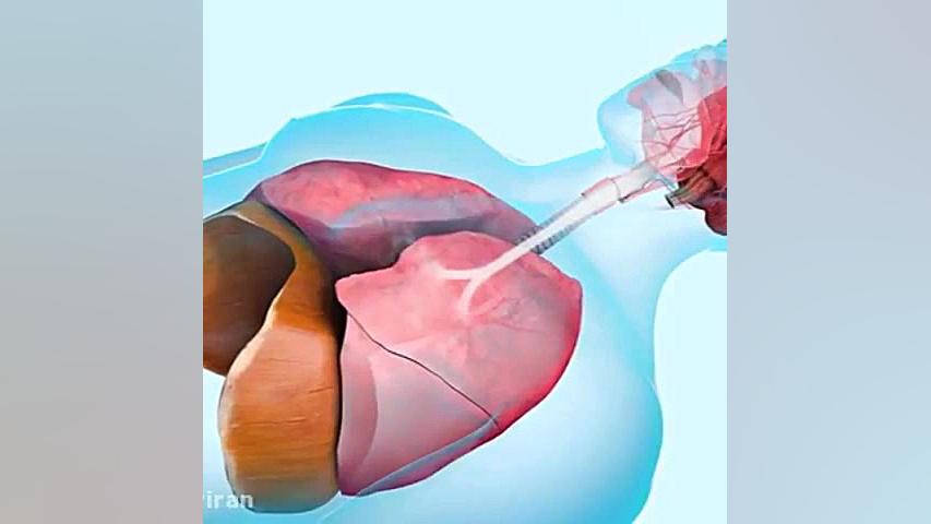 چرا خروپف میکنم ؟ دکتر فریبا معینی پور