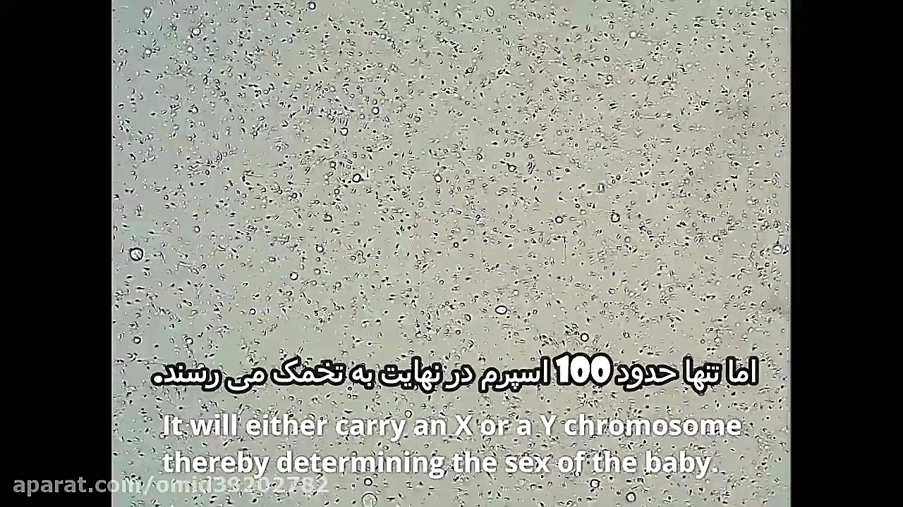 اسپرم منی زیر میکروسکوپ با وضوح 1000 برابر هوش مصنوعی ترند