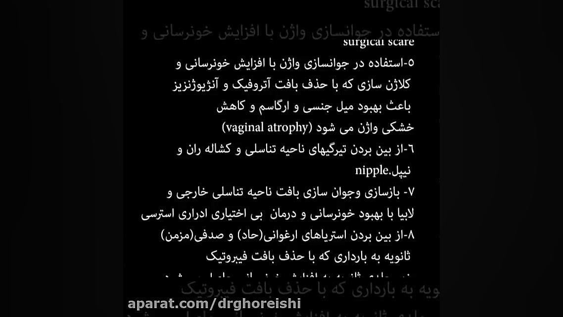 کربوکسی تراپی واژن | دکتر بنفشه قریشی متخصص زنان و زایمان اندودنتیکس