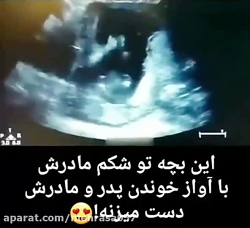 دست زدن نوزاد در رحم مادر