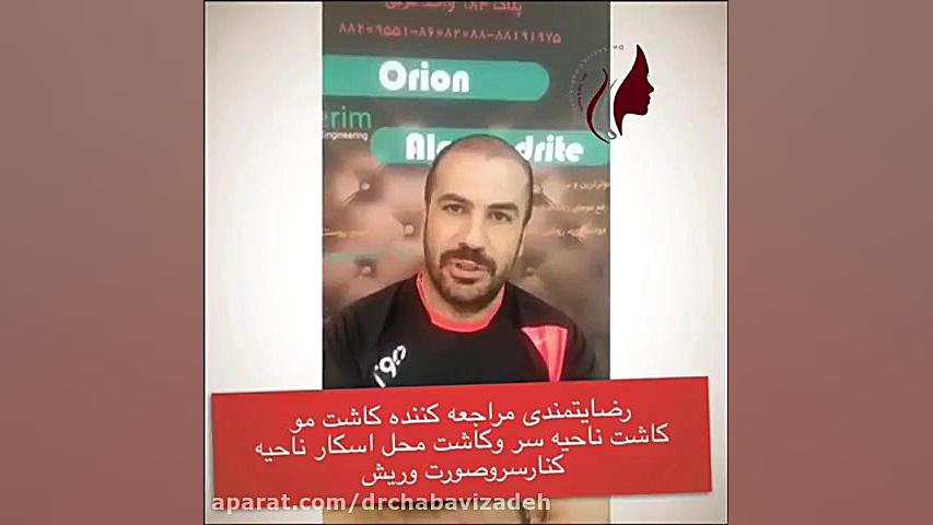 رضایتمندی بیمار از روند کاشت مو توسط دکتر چعباوی زاده دکتر صفیه چعباوی زاده