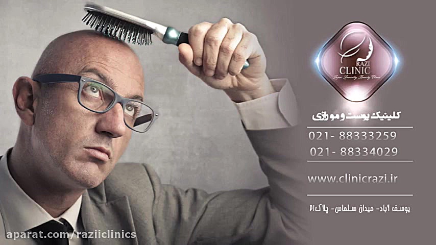 کاشت مو - برداشت گرافت مو از ریش و بدن سیتوژنتیک مولکولی