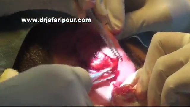 جراحی زیبایی گوش دکتر مسعود جعفری پور