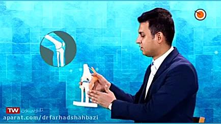 توضیحات دکتر شهبازی،پزشک جراح متخصص ارتوپدی،در مورد آسیب رباط صلیبی زانو26712439 پروتز دندان