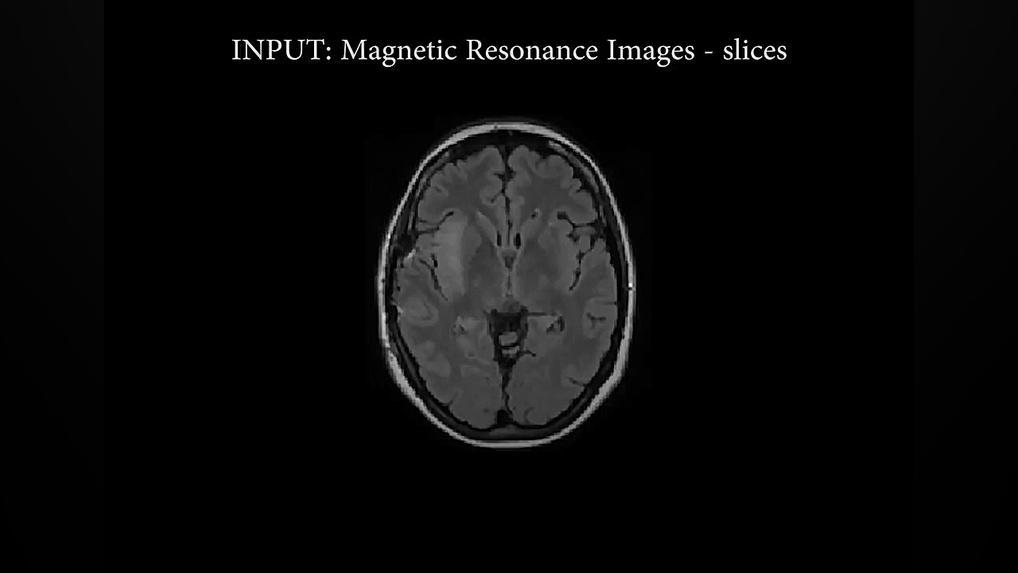 Segmentation of Brain Tumors from Magnetic Resonance Images اوتیلومیومبر