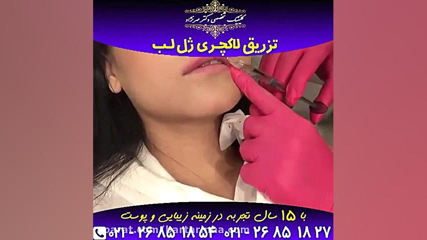 برترین ها - کلینیک پوست و مو، زیبایی و لاغری باران - دکتر مهرنژاد مایکروگناتیا