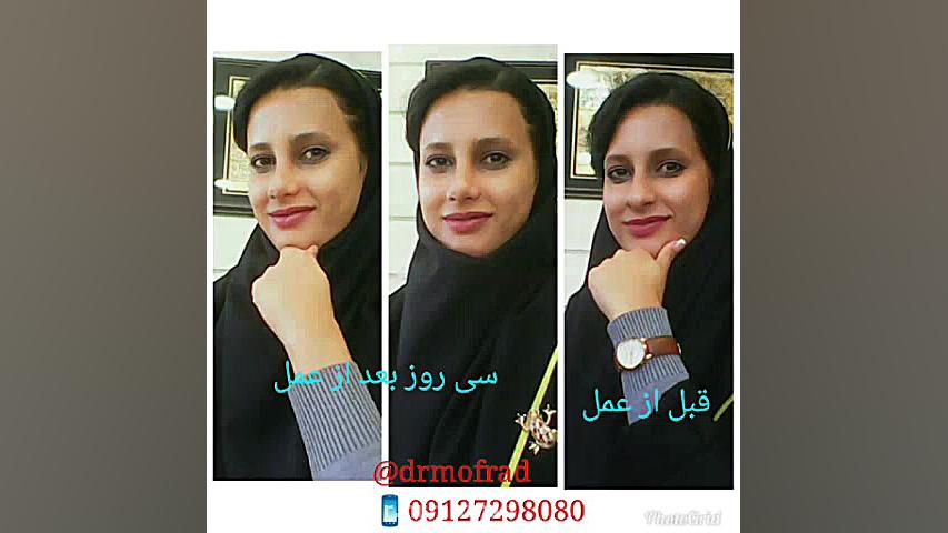 ویدئو ارسالی مراجعین عزیز بعد از عمل ( کلیپ هنری ) دکتر حمیدرضا مفرد