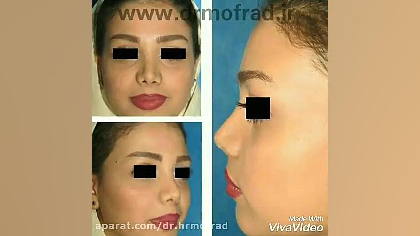 کلیپ تهیه شده از قبل و بعد عمل مراجعین محترم دکتر حمیدرضا مفرد