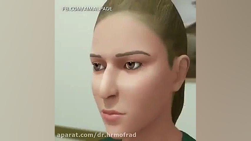 شماتیک جراحی بینی دکتر حمیدرضا مفرد