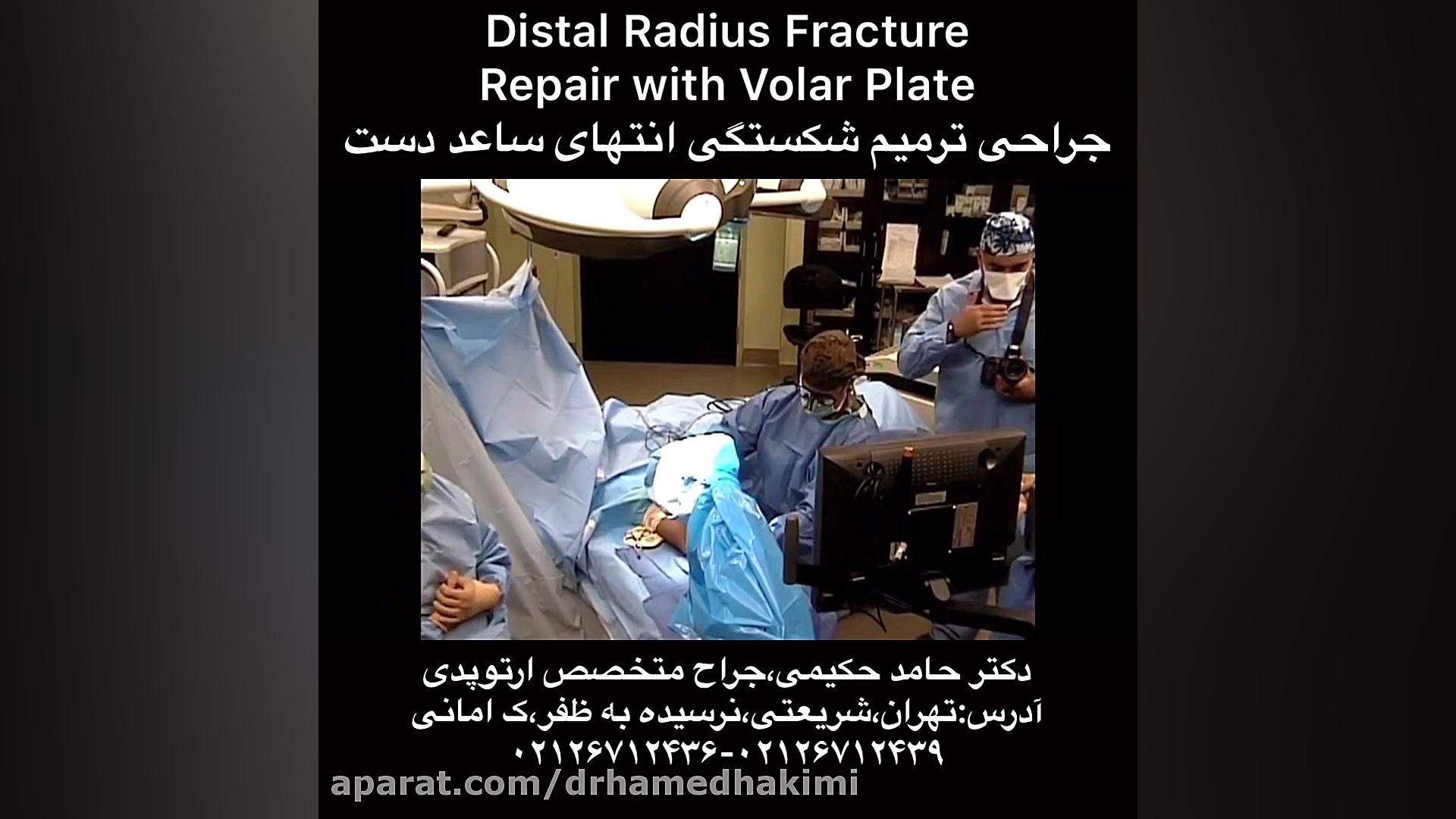 جراحی شکستگی ساعد در ناحیه مچ دست،دکتر حکیمی،پزشک جراح متخصص ارتوپدی 26712439 دندان پیش