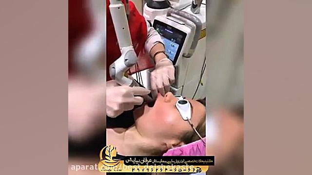 فیلم جوانسازی پوست TEVAR