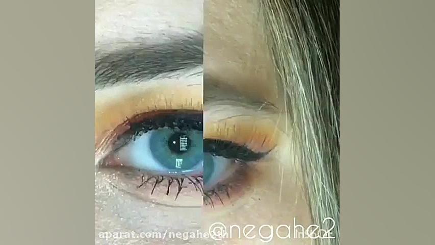 لنز لابلا _ رنگ لازرد علامت بابینسکی