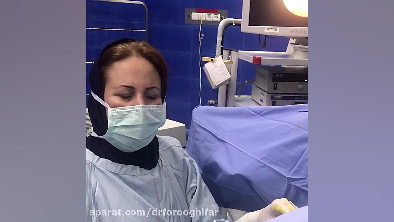 هیستروسکوپی و‌پولیپکتومی رحم همراه با کورتاژ تشخیصی رحم لیپوساکشن