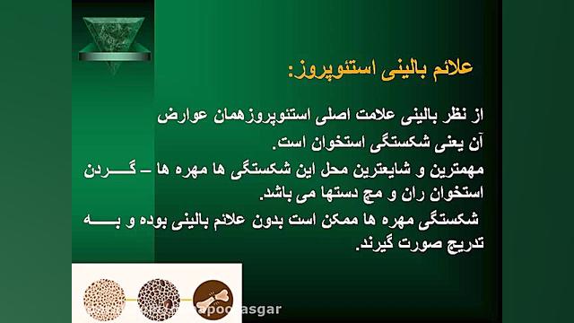 پوکی استخوان لیپوست