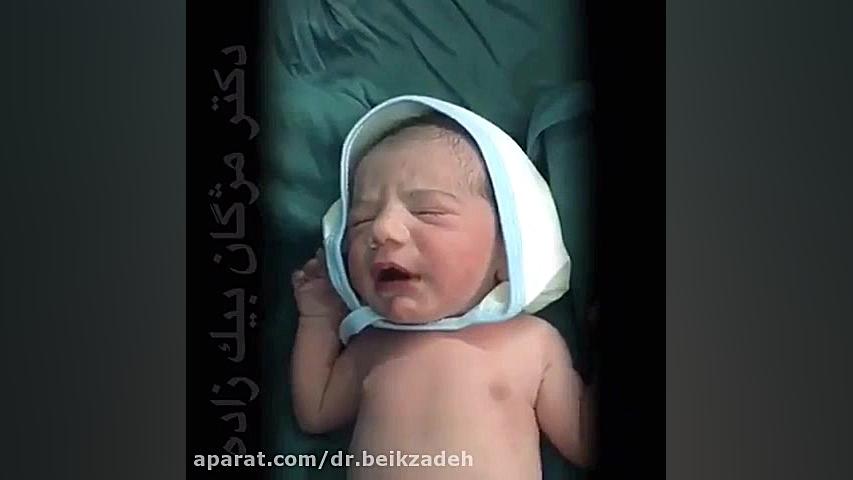 فیلم عمل سزارین توسط دکتر مژگان بیک زاده دکتر مژگان بیک زاده ( جراح و متخصص زنان و زایمان)