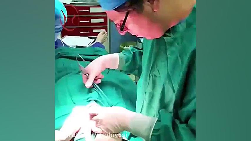 جراحی زیبایی پلک دکتر سینا غیاثی حافظی