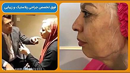 جراحی لیفتینگ صورت دکتر سینا غیاثی حافظی