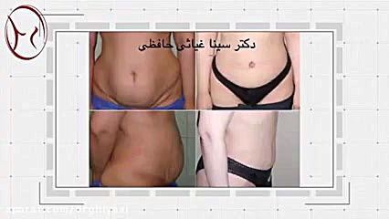 خدمات دکتر سینا غیاثی حافظی فوق تخصص جراحی، پلاستیک و زیبایی دکتر سینا غیاثی حافظی