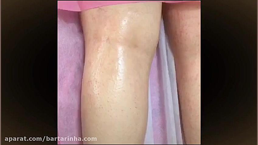 برترین ها - دکتر فرشاد حسینی - کلینیک پوست مو و زیبایی CUT&RUN