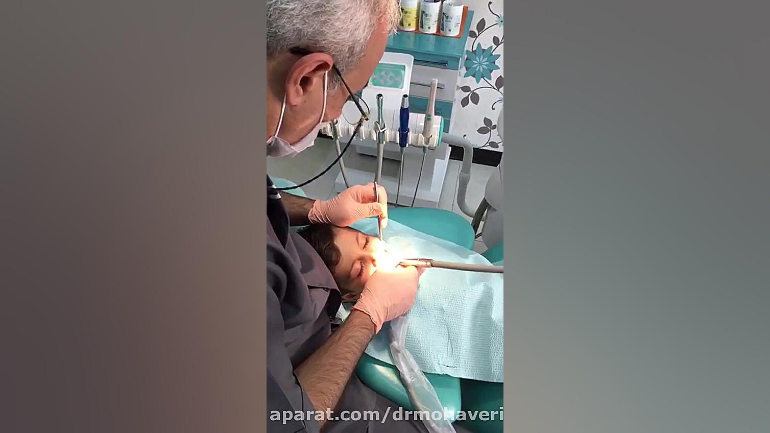 درمان دندانپزشکی کودکان دکتر مصطفی محاوری رتروگناتیا