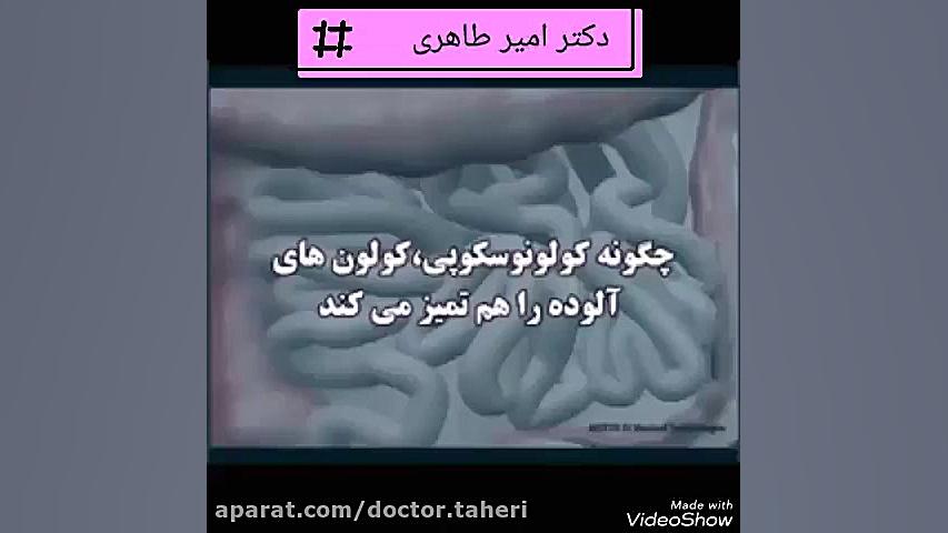 کولونوسکوپی تزریق چربی