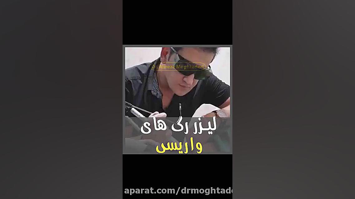 لیزر رگهای واریسی و تلانژکتازی دکتر علیرضا مقتدری | متخصص طب فیزیکی