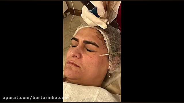 برترین ها - مرکز مراقبت و زیبایی پوست و مو به دی اصلاح فرم صورت