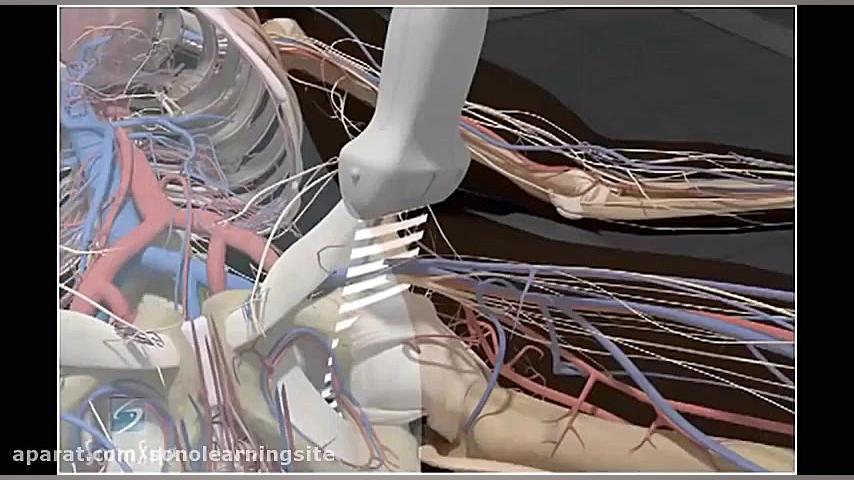 3D How To- Deep Vein Thrombosis Ultrasound Exam - SonoSite Ultrasound عمه پری