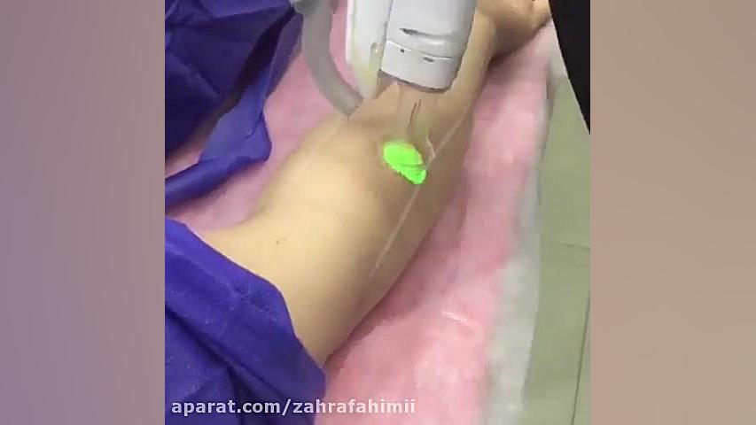 لیزر موهای زائد نواحی خاص Live Cell Microscopy