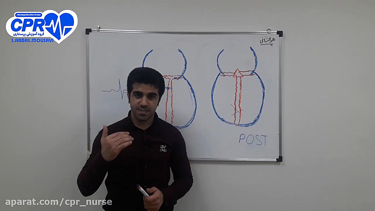تفسیر ECG قسمت (5) کاشت ابرو
