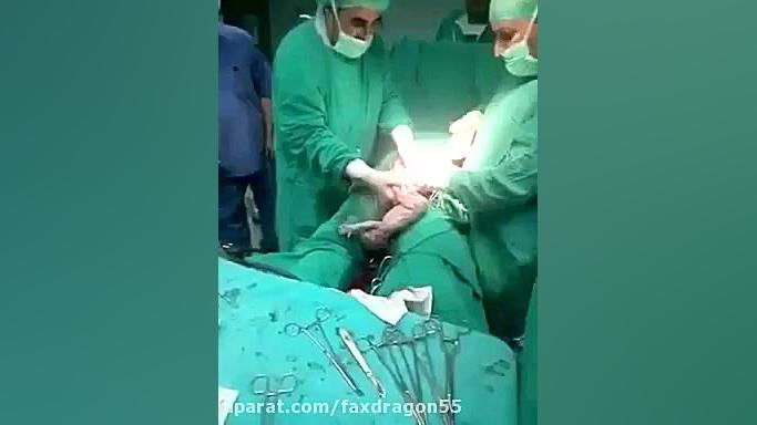 عمل جراحی و لحظه تولد شش قلو ها در اتاق عمل رفع غبغب