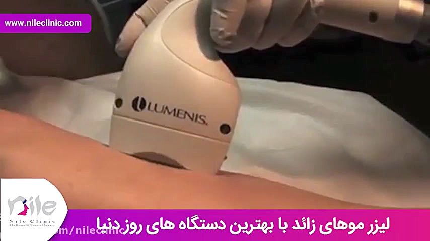لیزر موهای زائد | فیلم لیزر موهای زائد | کلینیک پوست و مو نیل | شماره 5 CUT&Tag