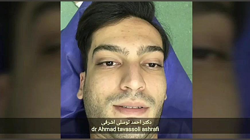 جراحی زیبایی بینی جراحی بینی دکتر احمد توسلی اشرفی