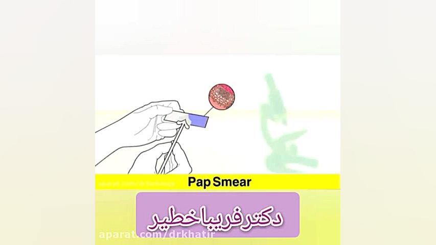 تست پاپ اسمیر دندانپزشک زیبایی