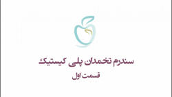 تنبلی تخمدان یا سندرم تخمدان پ...